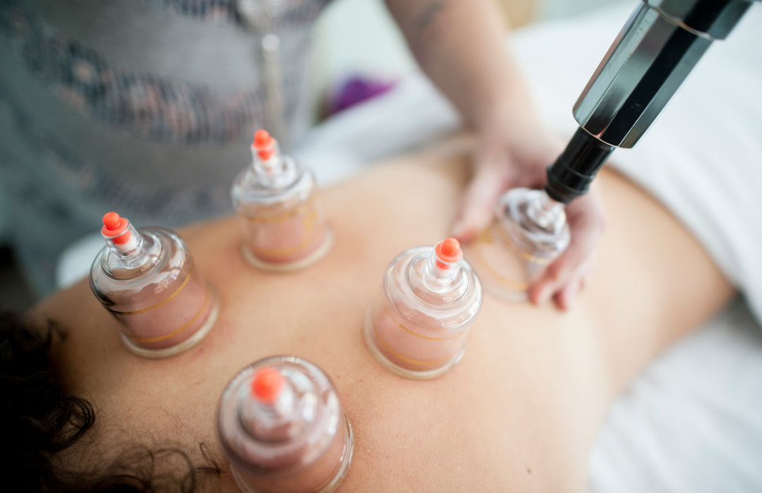 Cupping Therapy: Unveiling the Ancient Healing Practice for Modern Wellness